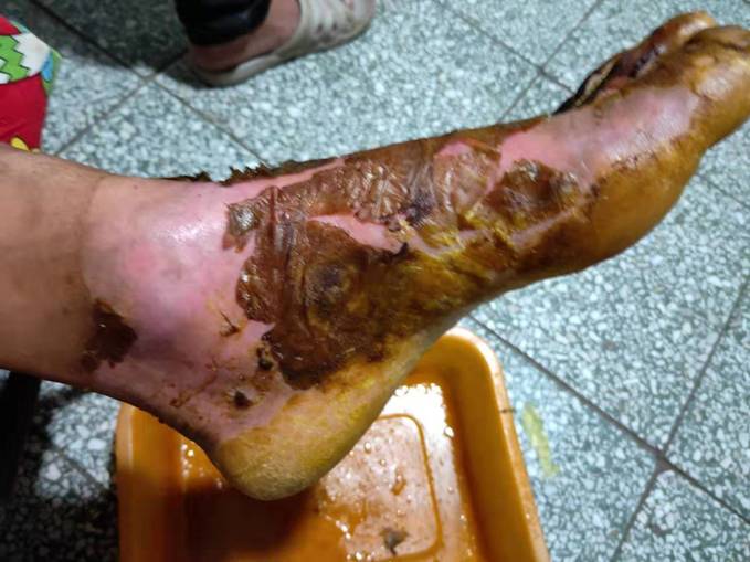 复生神力多用膏 烧伤,烫伤,褥疮治疗 福生堂 名医祖传秘方 国家发明